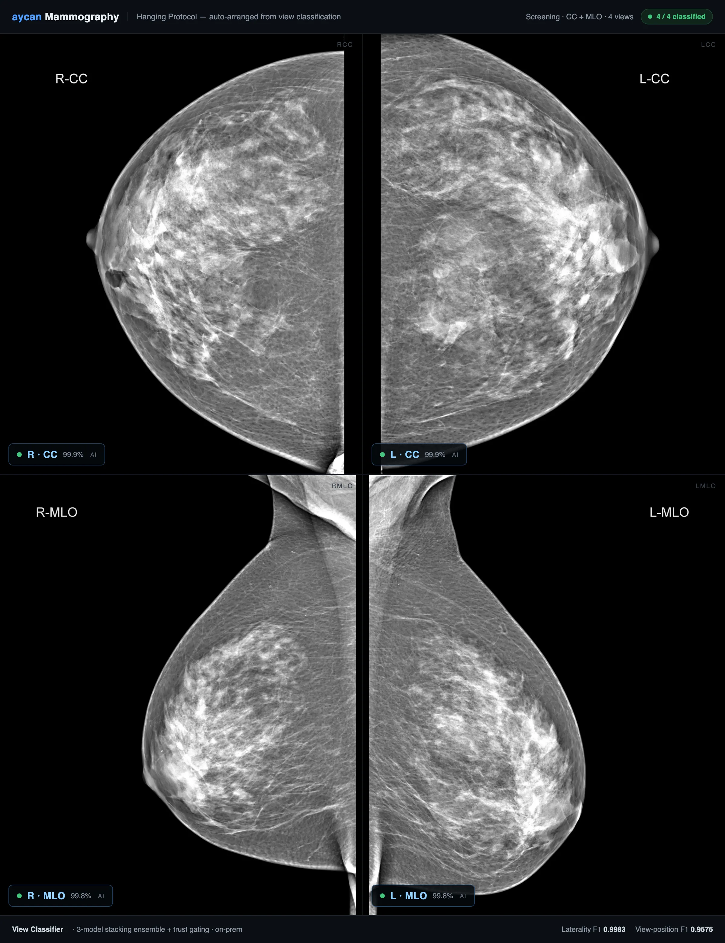 Dark PACS-style mammography hanging protocol: four de-identified screening views in a 2×2 grid — right and left craniocaudal on top, right and left mediolateral-oblique below — each tagged with an AI-predicted laterality and view-position label and confidence, above a footer showing the model's F1 scores.